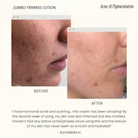 Firming Lotion