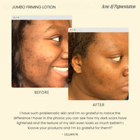 Firming Lotion