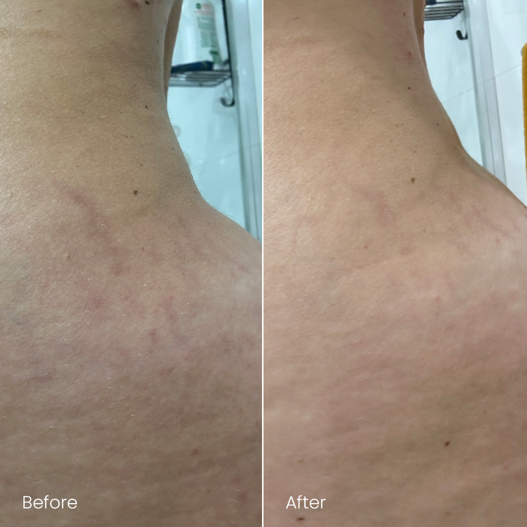 This Firming Lotion is a pregnancy game changer!!!!!